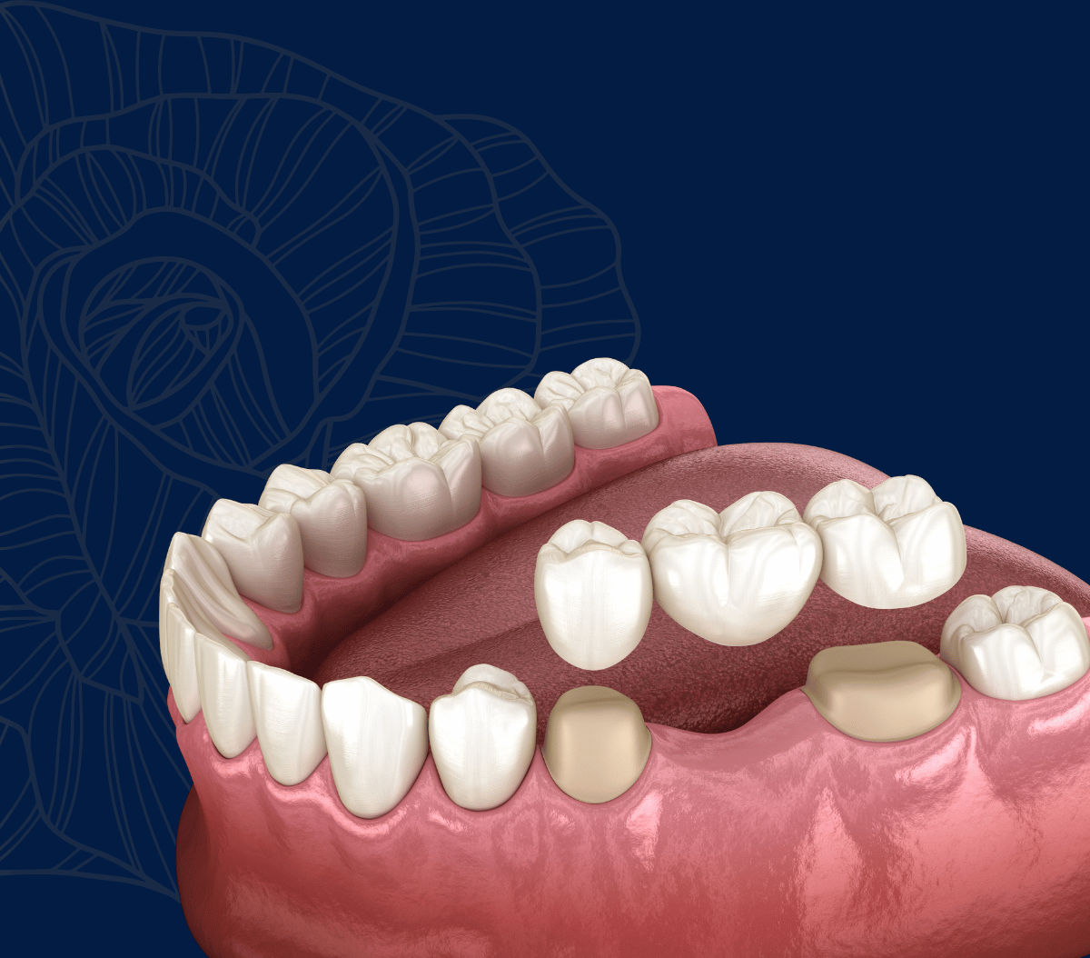 Treatment - Infinity Dental Solihull